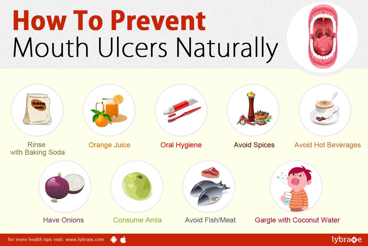 how-to-prevent-mouth-ulcers-naturally-by-dr-dinesh-rawal-lybrate