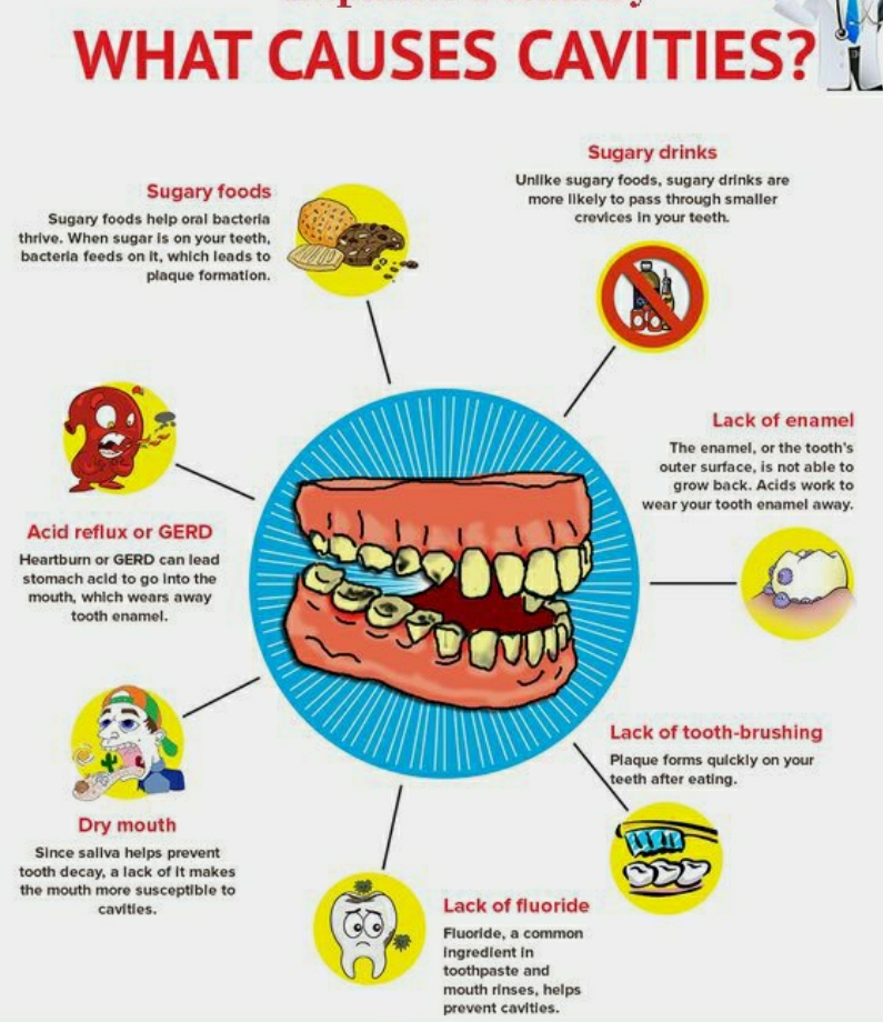 What Causes Cavities? - By Dr. Garima Malhotra | Lybrate