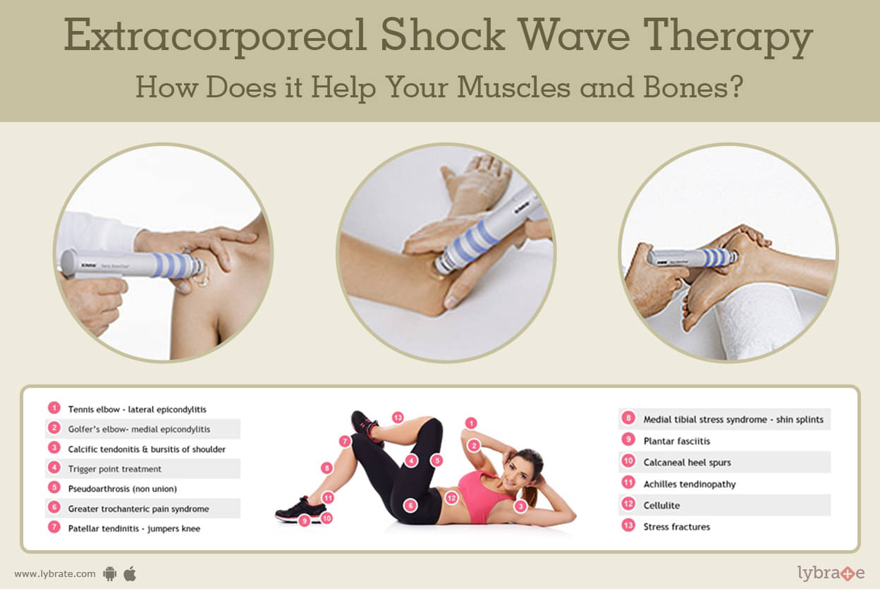 shock wave treatment for heel spurs
