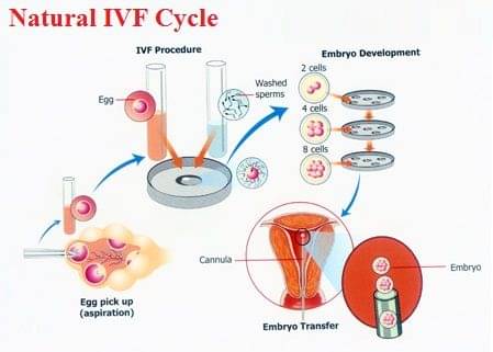 Benefits Of Natural IVF - By Dr. Richika Sahay Shukla 