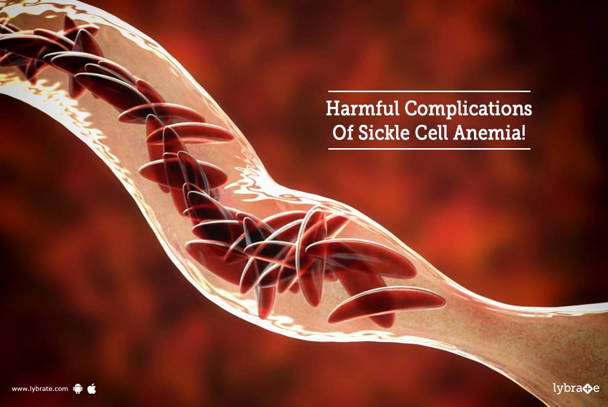 harmful-complications-of-sickle-cell-anaemia-by-dr-sanjeev-kumar