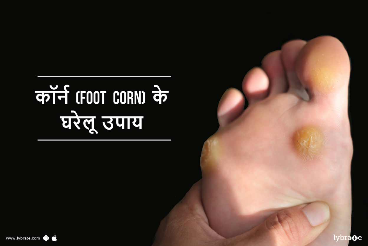 foot corn treatment in hindi