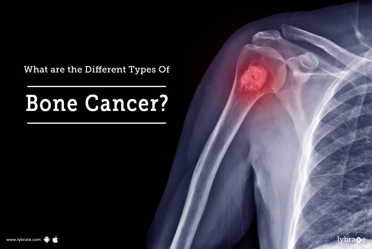 essay on bone cancer