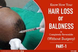 How your hair loss or baldness is completely reversible (non-surgically)<br/><br/>Having deeply r...