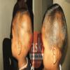 Ayur skin clinic Image 4