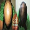 Ayur skin clinic Image 3