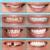 Smile Up Dental Care & Implant Center Image 5