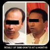 Delight Clinic - Hair Transplant,Laser & Cosmetic Surgery Centre Image 3