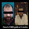 Delight Clinic - Hair Transplant,Laser & Cosmetic Surgery Centre Image 10