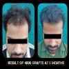 Delight Clinic - Hair Transplant,Laser & Cosmetic Surgery Centre Image 2
