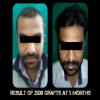 Delight Clinic - Hair Transplant,Laser & Cosmetic Surgery Centre Image 4