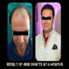 Delight Clinic - Hair Transplant,Laser & Cosmetic Surgery Centre Image 5
