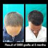 Delight Clinic - Hair Transplant,Laser & Cosmetic Surgery Centre Image 7