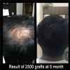 Delight Clinic - Hair Transplant,Laser & Cosmetic Surgery Centre Image 1