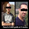 Delight Clinic - Hair Transplant,Laser & Cosmetic Surgery Centre Image 8