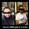 Delight Clinic - Hair Transplant,Laser & Cosmetic Surgery Centre Image 9