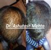 Dr. Mehta's Skin Clinic Image 2