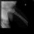 ORTHOPEDIC CLINIC- MAGNA CLINICS Image 3