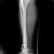 ORTHOPEDIC CLINIC- MAGNA CLINICS Image 4