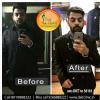 Diet Clinic - Jalandhar Image 9