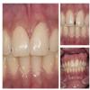 Bhandari Dental Clinic Image 10