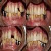 Bhandari Dental Clinic Image 7