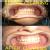 We Relieve Your Pain At Karun'S Dental Clinic Image 2