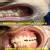 We Relieve Your Pain At Karun'S Dental Clinic Image 4