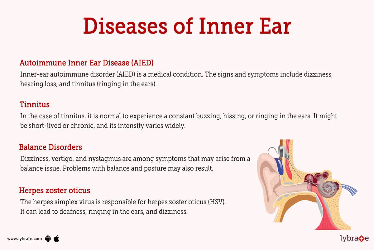 Tinnitus Disease Concept Pain Inflammation Human Stock Vector (Royalty  Free) 2045184647 | Shutterstock