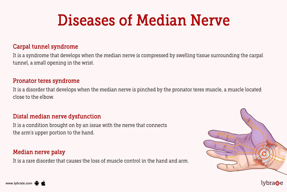 Median Nerve - an overview