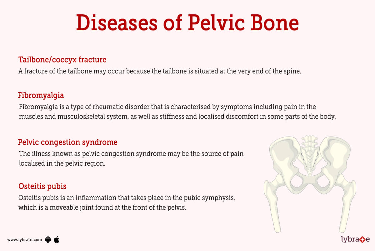 Pelvic Bones (Human Anatomy): Picture, Functions, Diseases, and Treatments