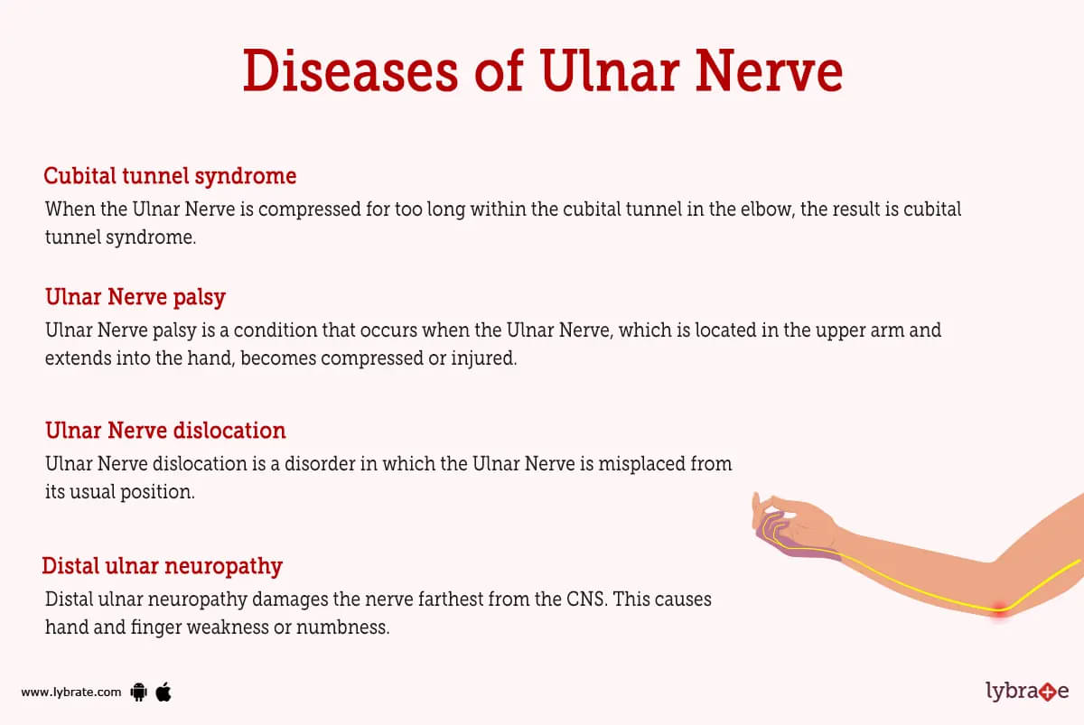 ULNAR NERVE INJURY ,CAUSES ,SYMPTOMS ,DIAGNOSIS AND TREATMENT
