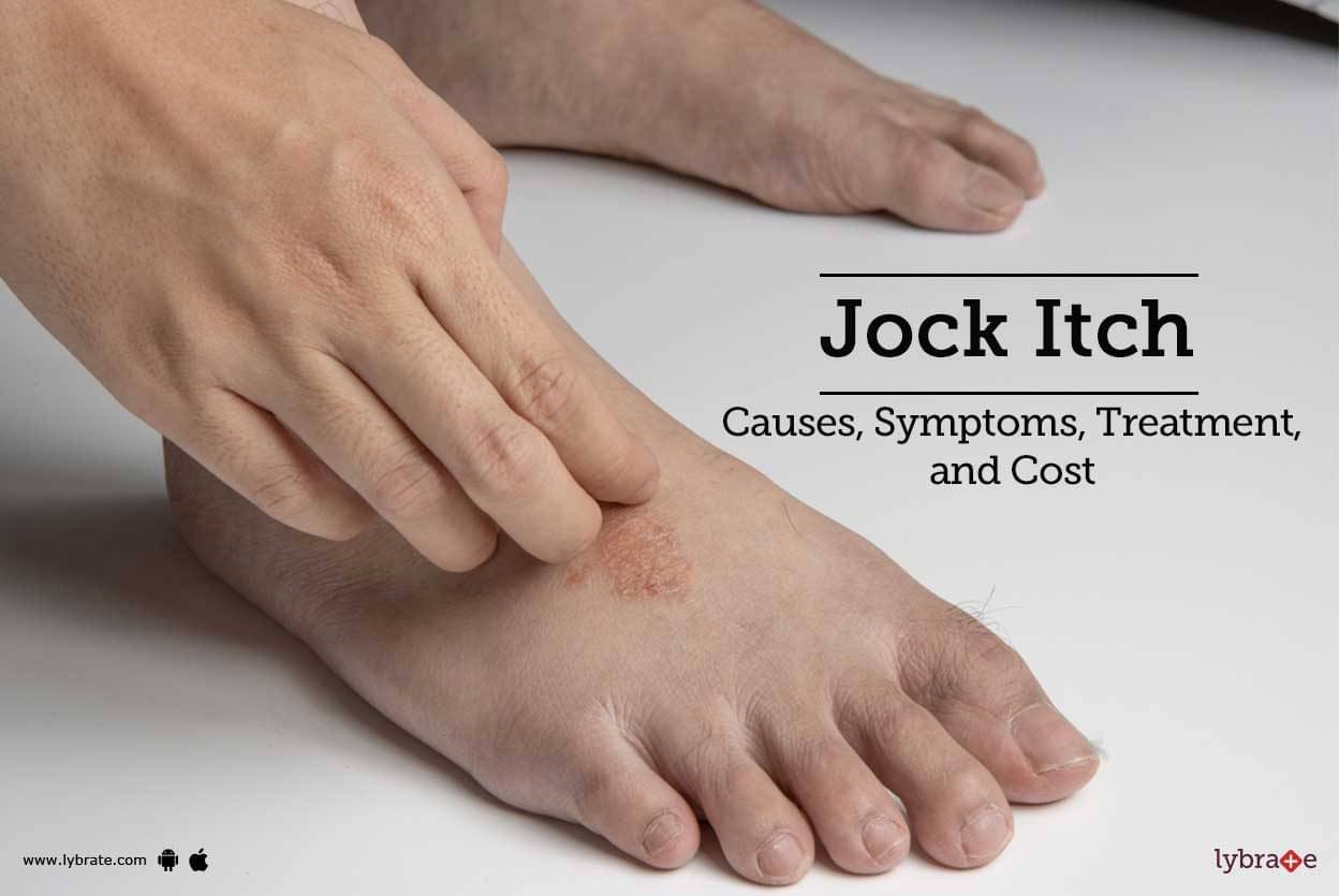 jock-itch-treatment-procedure-cost-recovery-side-effects-and-more