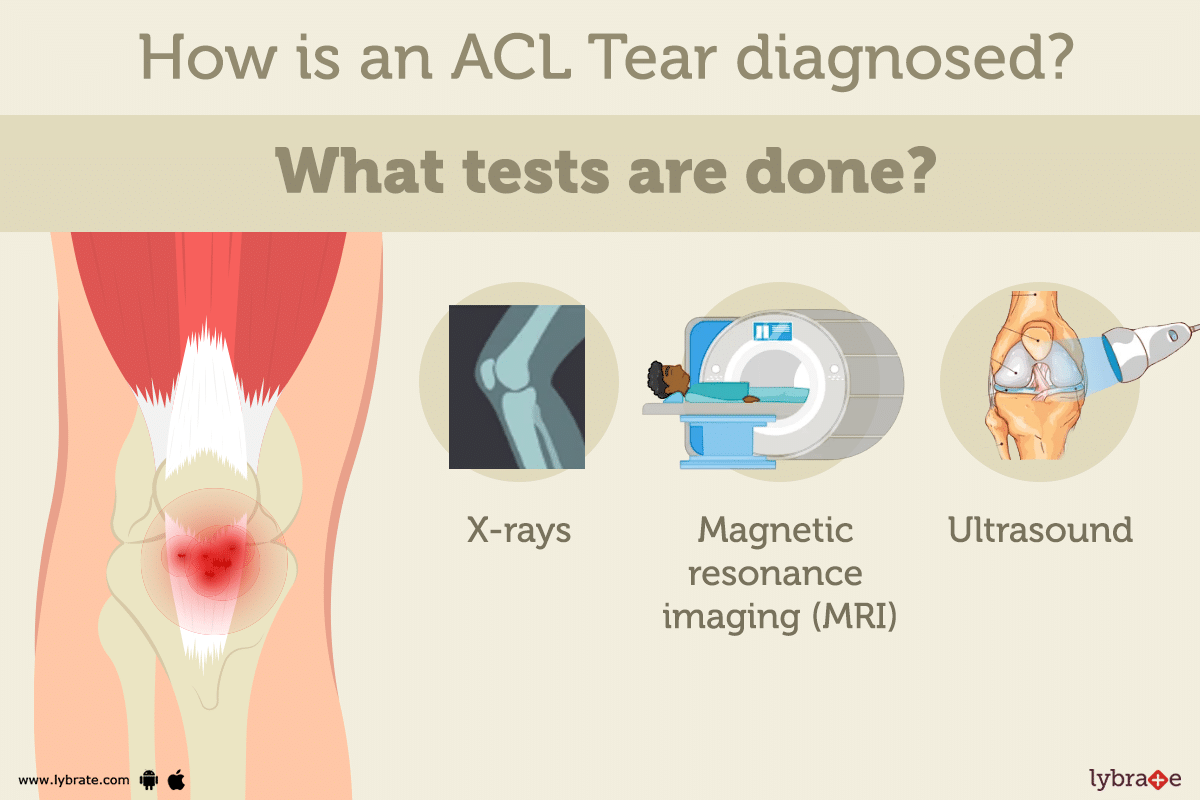 ACL Tear Symptoms