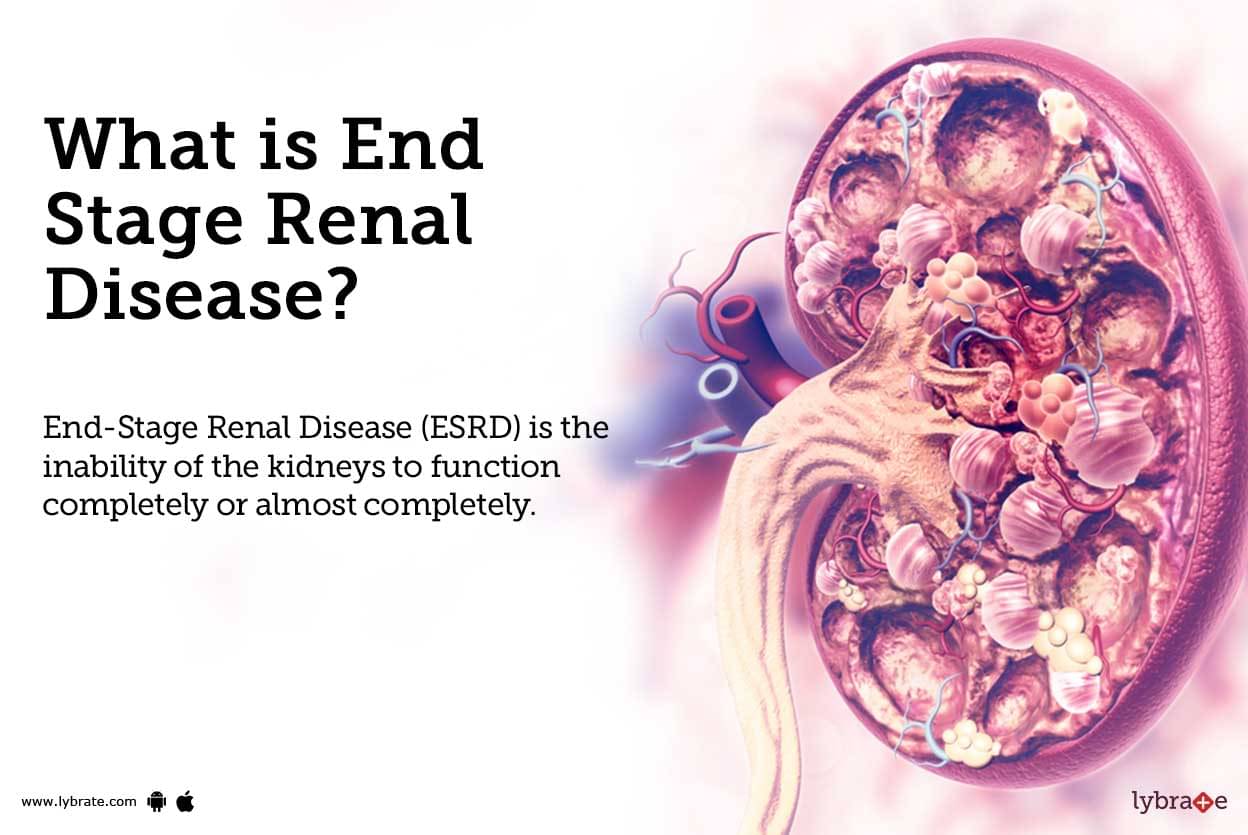 What Is End Stage Renal Disease Egfr