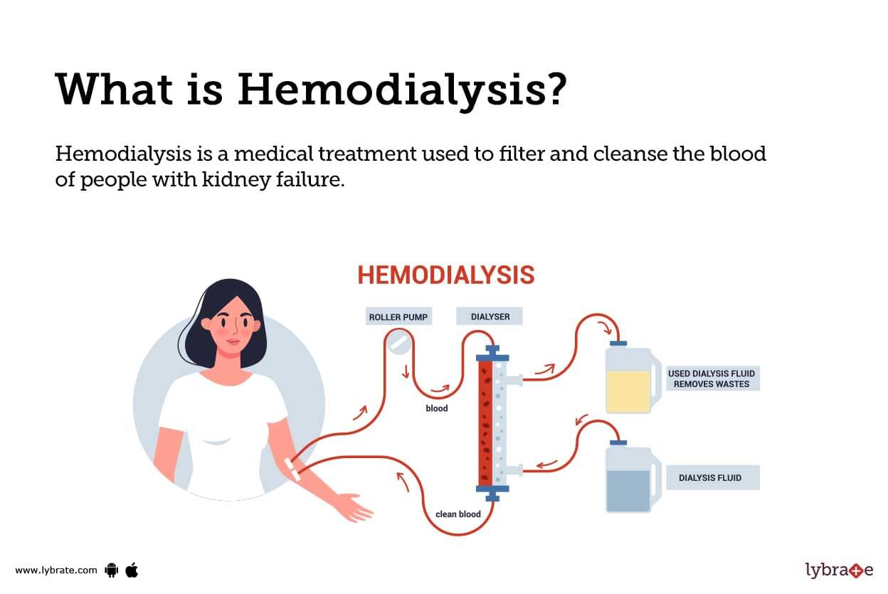 hemodialysis