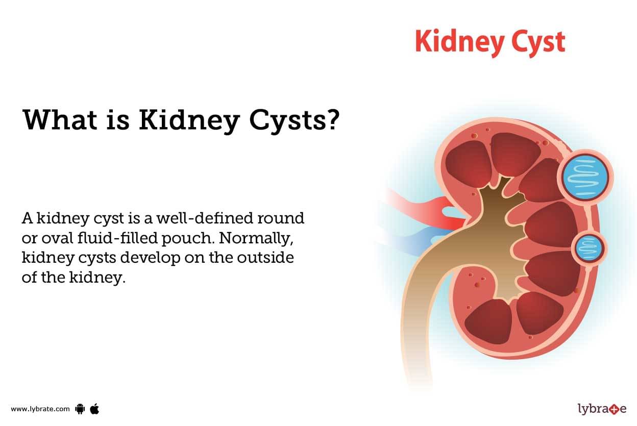 kidney cyst ultrasound and biopsy procedure