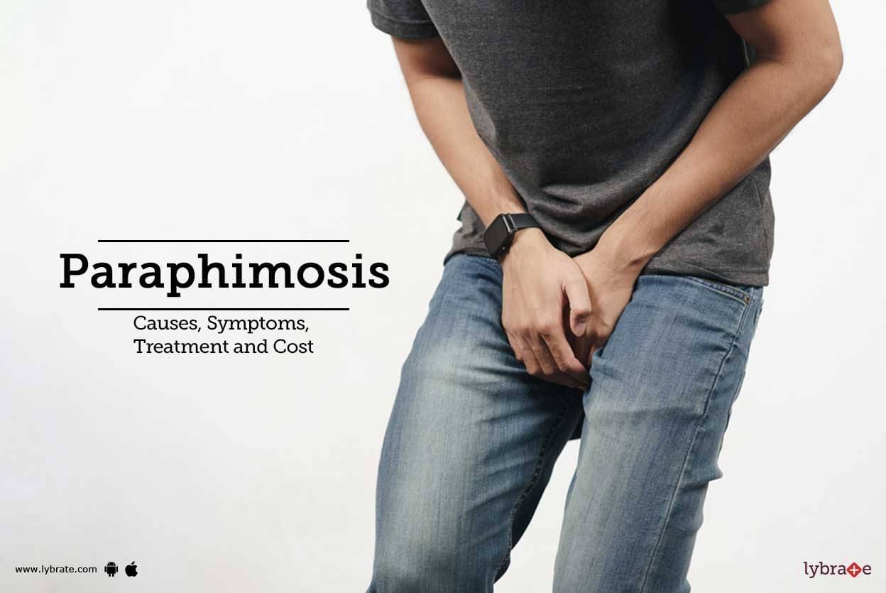 Phimosis: Causes, Diagnosis & Treatment - India IVF