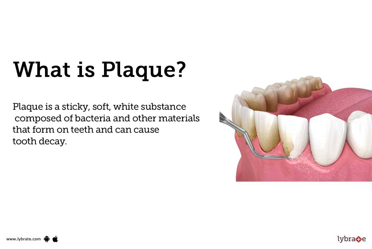 Plaque: Causes, Symptoms, Treatment and Cost