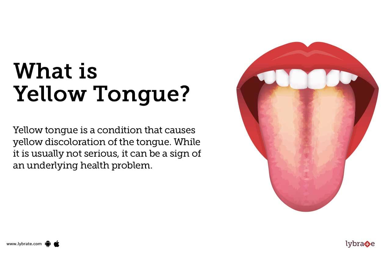 healthy tongue colour