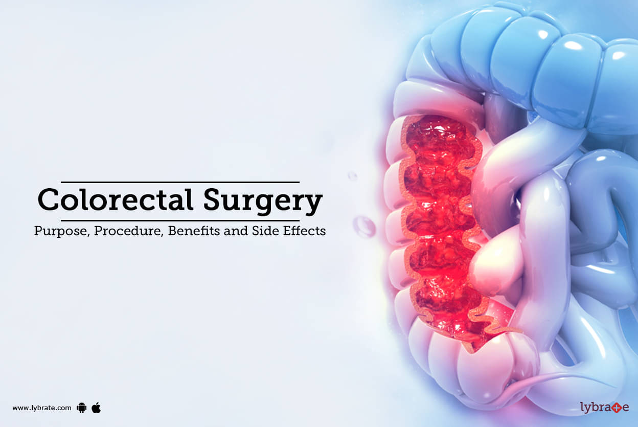 Colorectal Surgery Purpose, Procedure, and Benefits and Side Effects