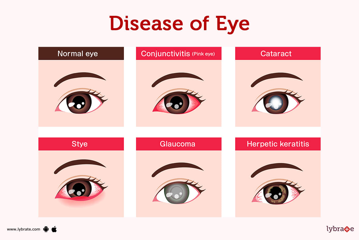 Eyes (Human Anatomy) Diagram, Optic Nerve, Iris, Cornea, Pupil, & More