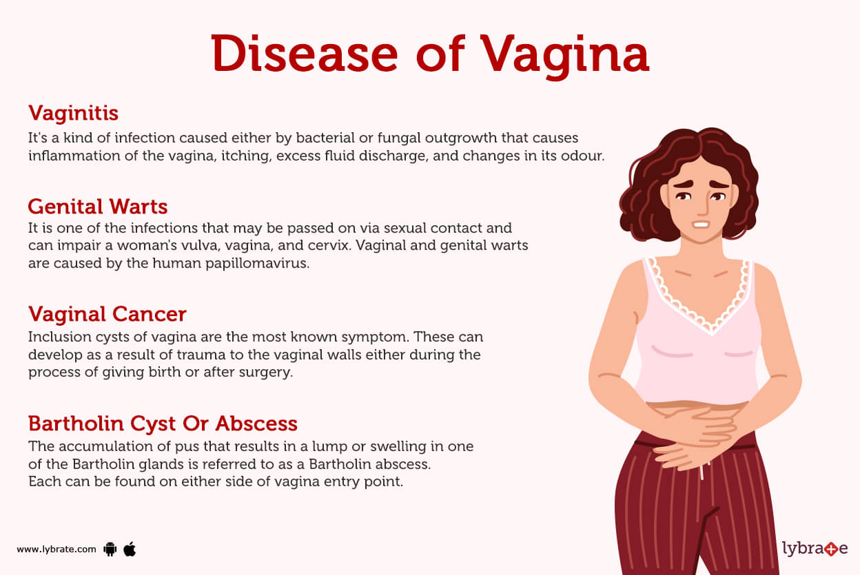 Vagina Vulva Female Anatomy Image Parts Function Problems