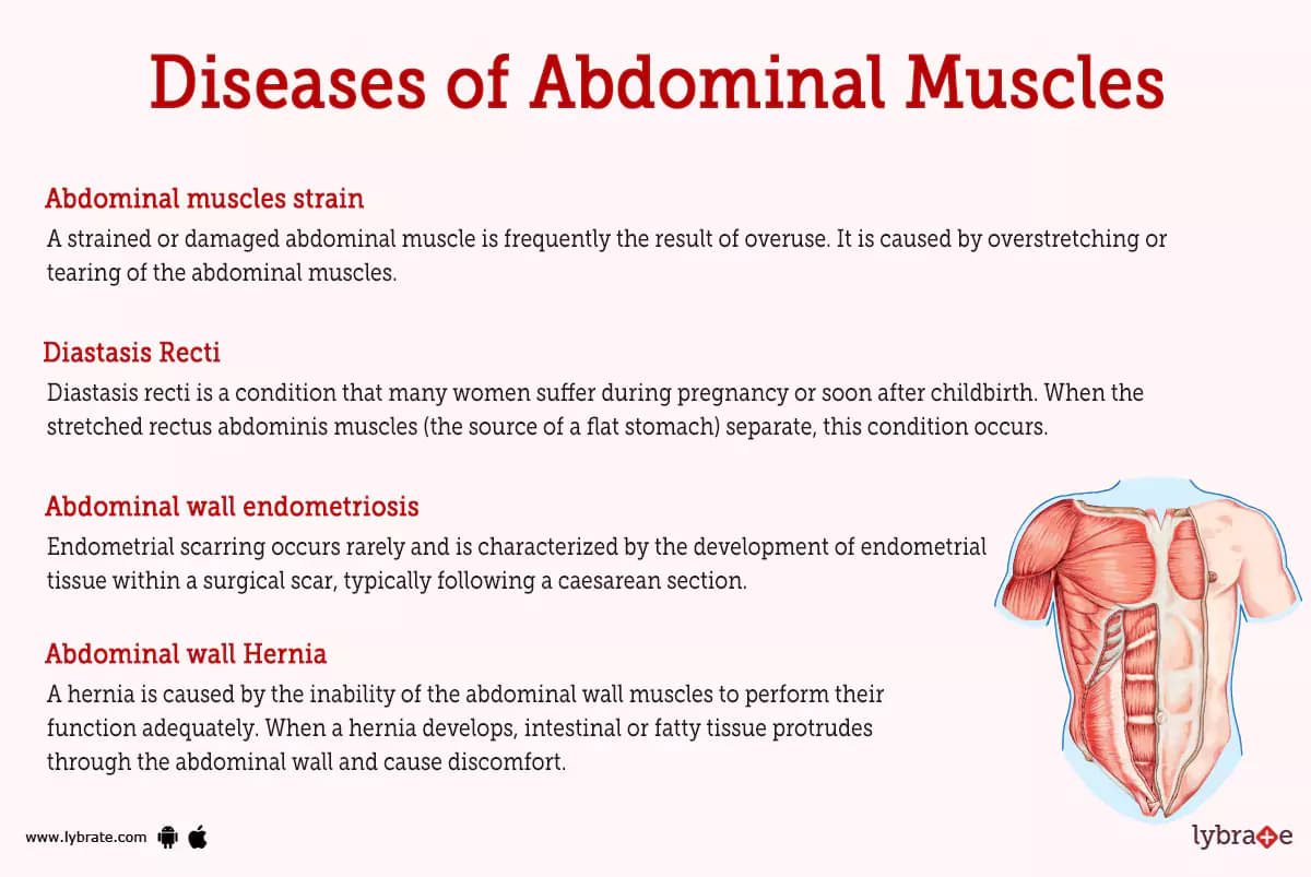 Abdominal muscles (Human Anatomy): Picture , Functions, Diseases