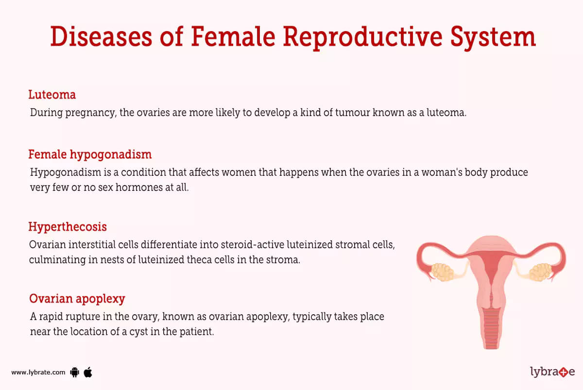 Female Reproductive System (Human Anatomy): Picture, Functions, Diseases,  and Treatments