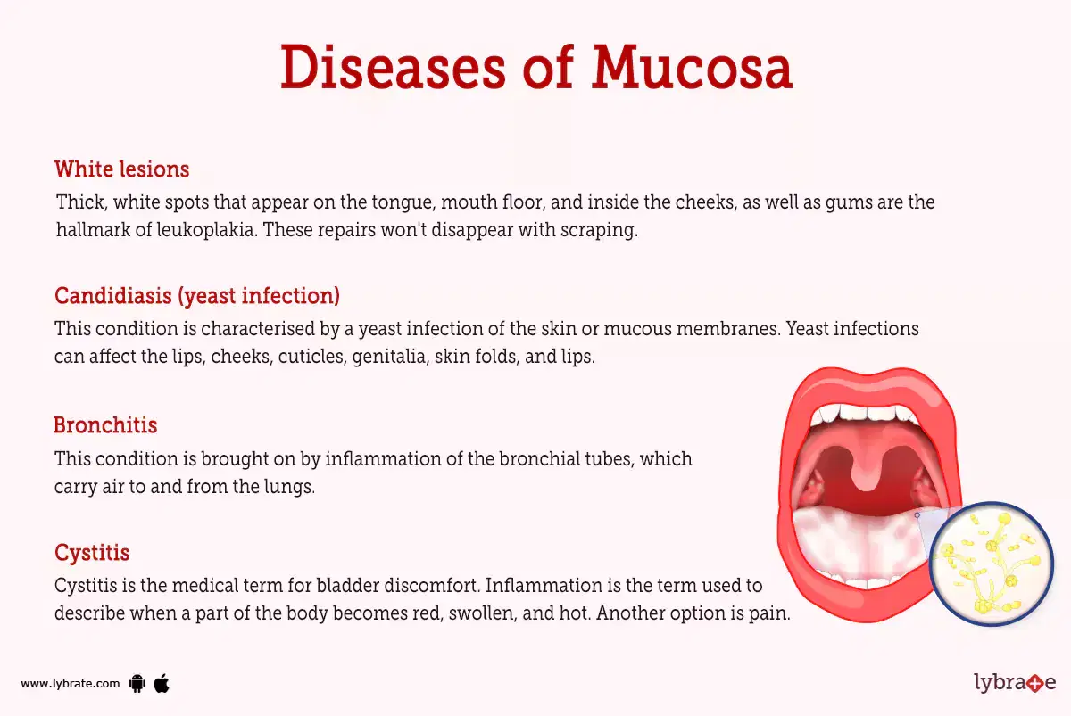 mucosa-human-anatomy-image-functions-diseases-and-treatments