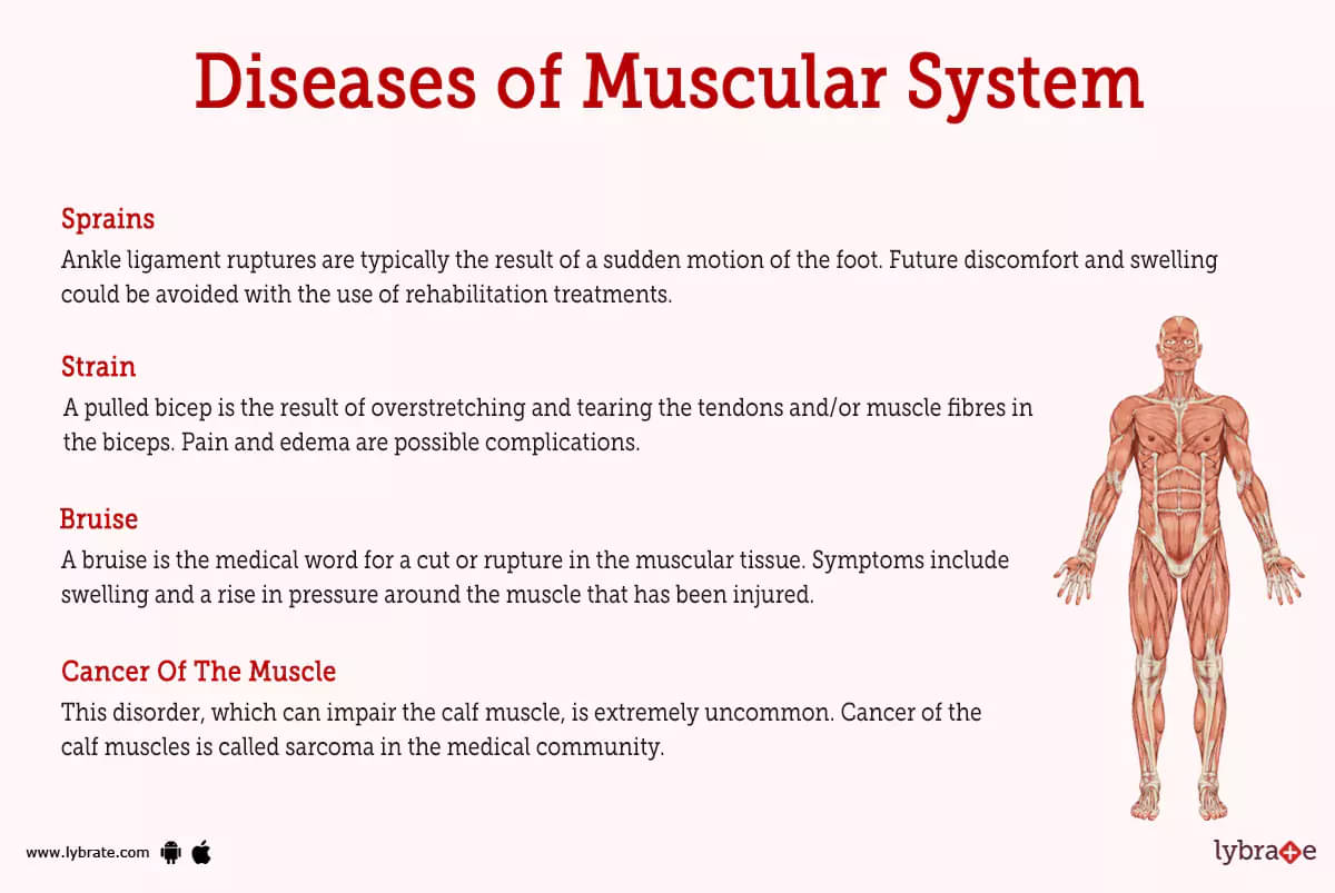 Description of muscle disease – specific diseases (Section 3B