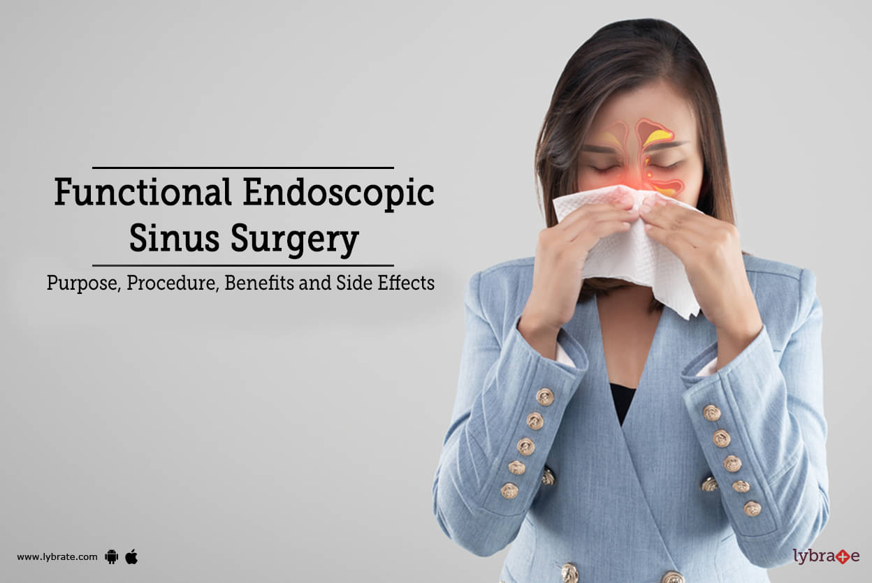 Functional Endoscopic Sinus Surgery Treatment Procedure Cost Recovery Side Effects And More 