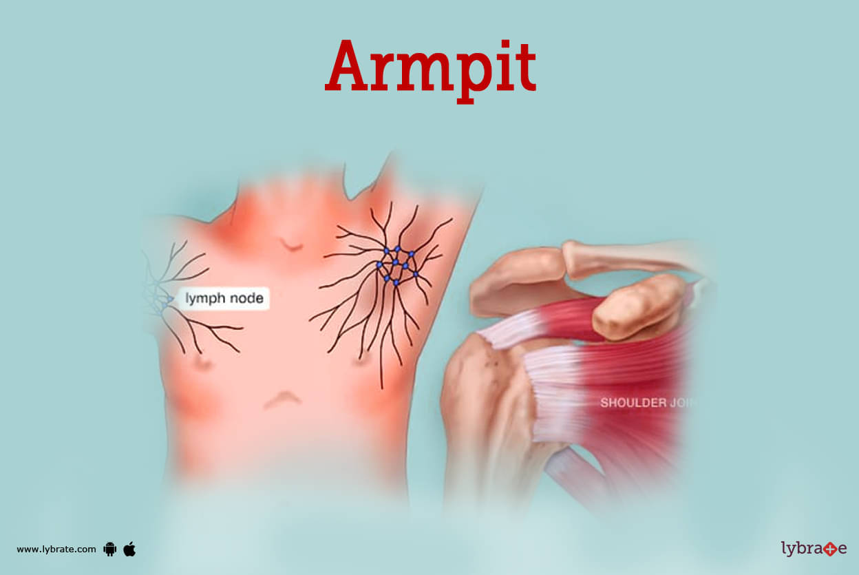 bacterial infection armpit lump