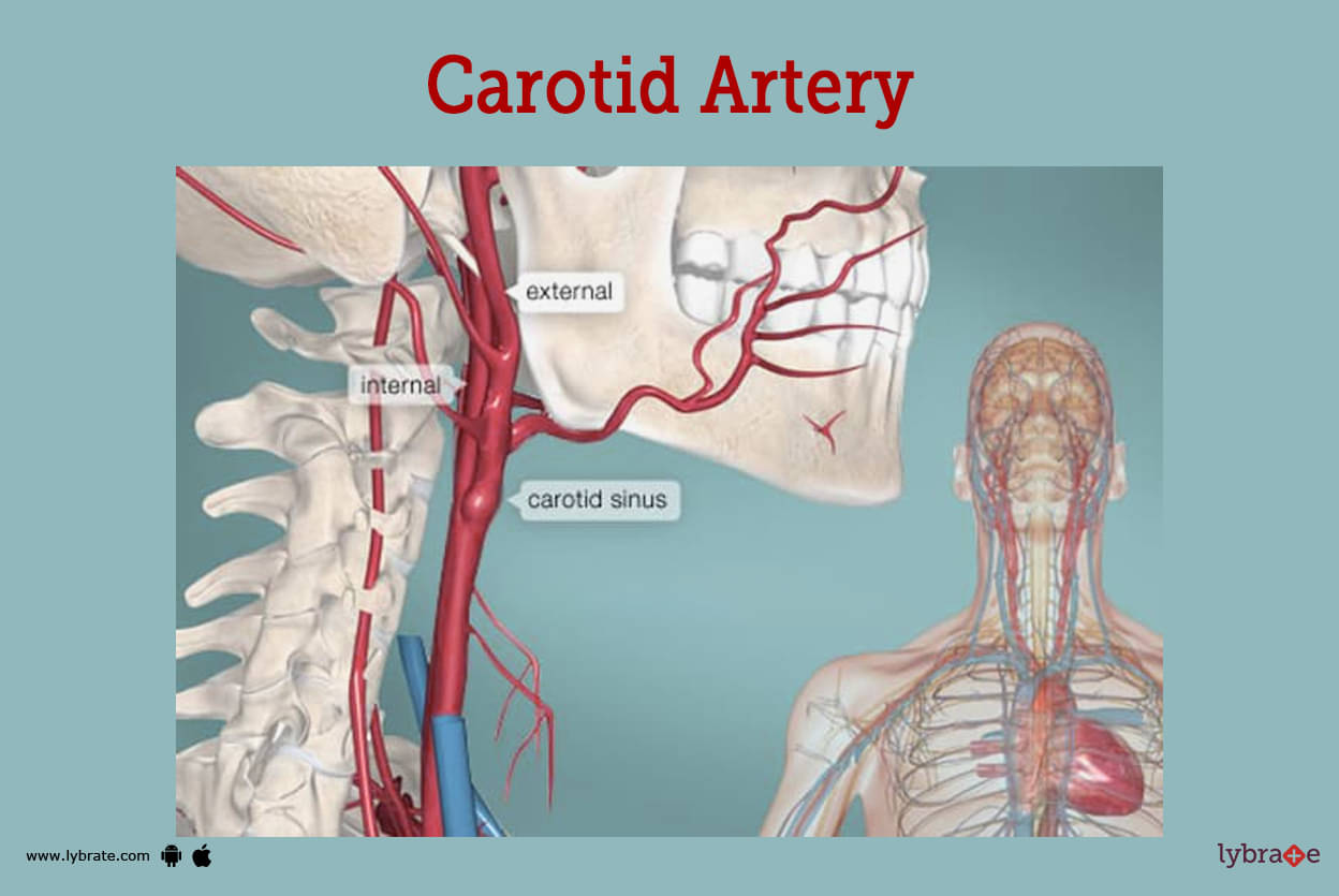 carotid artery brain prognosis